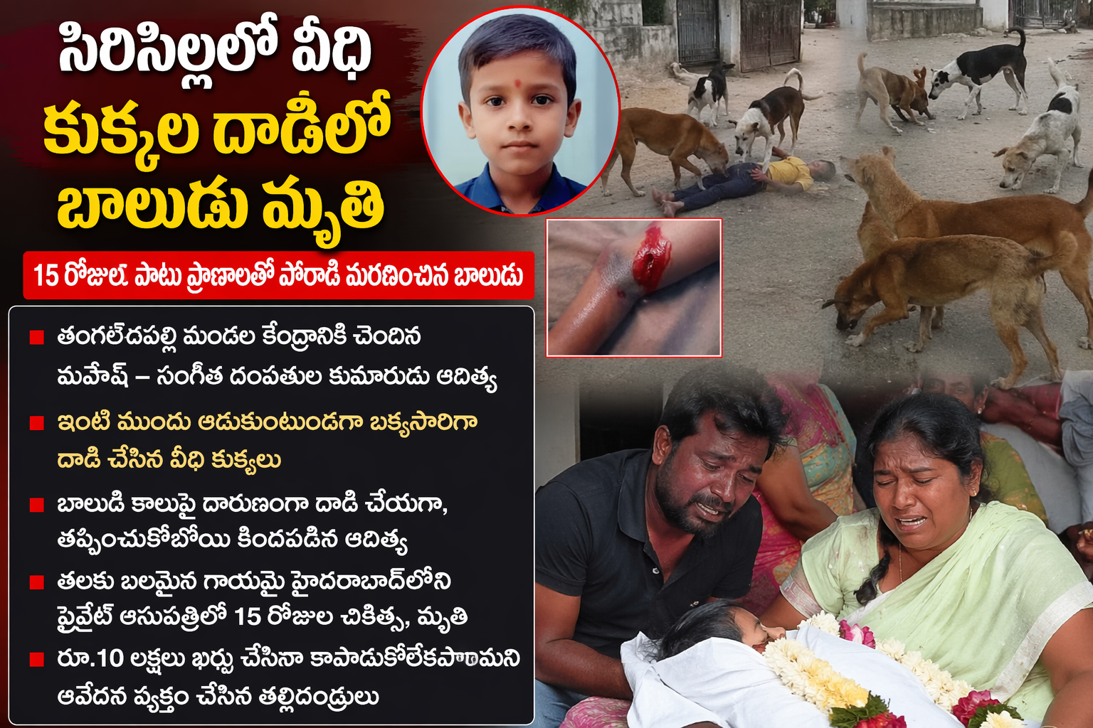 సిరిసిల్లలో వీధి కుక్కల దాడిలో బాలుడు మృతి 15 రోజుల పాటు చికిత్స పొందుతూ కన్నుమూసిన చిన్నారి