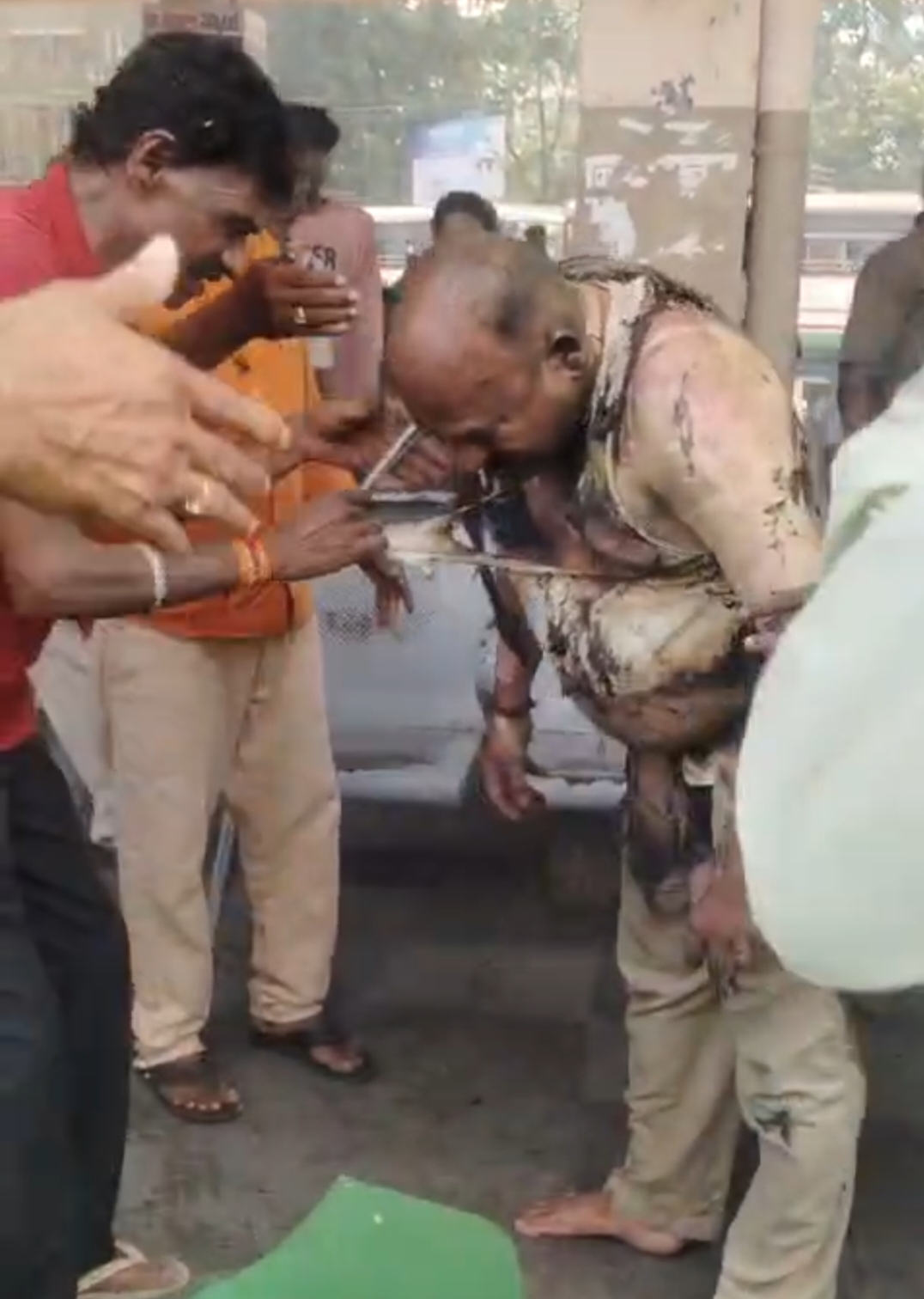 ఆర్టీసీ సమ్మె సమయంలో బస్సు డ్రైవర్ ఆత్మహత్యాయత్నం; ఆసుపత్రిలో చికిత్స