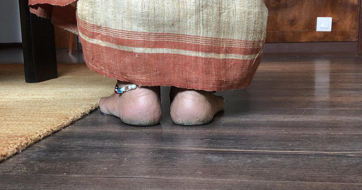 Krack Cream: Transforming Women’s Daily Struggles into a Market Revolution