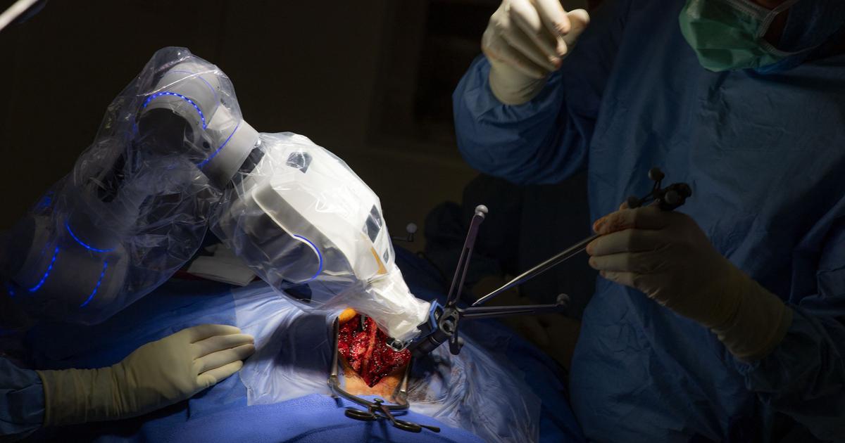 Revolutionizing Surgery: India's Foray into Robotic and Telesurgery